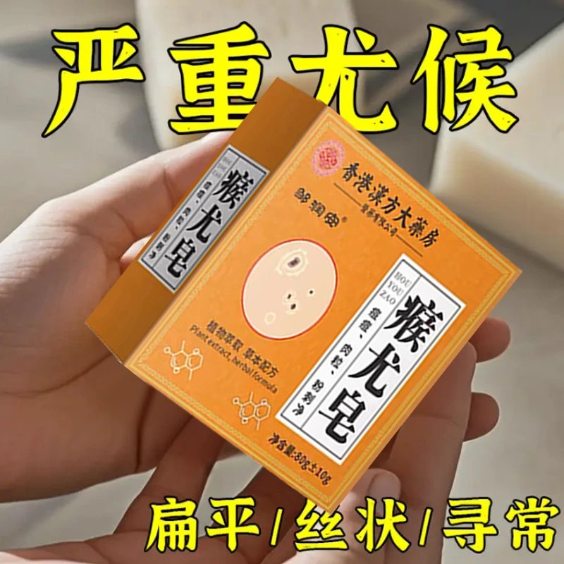 【亏本包邮】香港大药房瘊尤皂除螨去全身肉粒瘊子粉刺痘痘皮肤抑菌