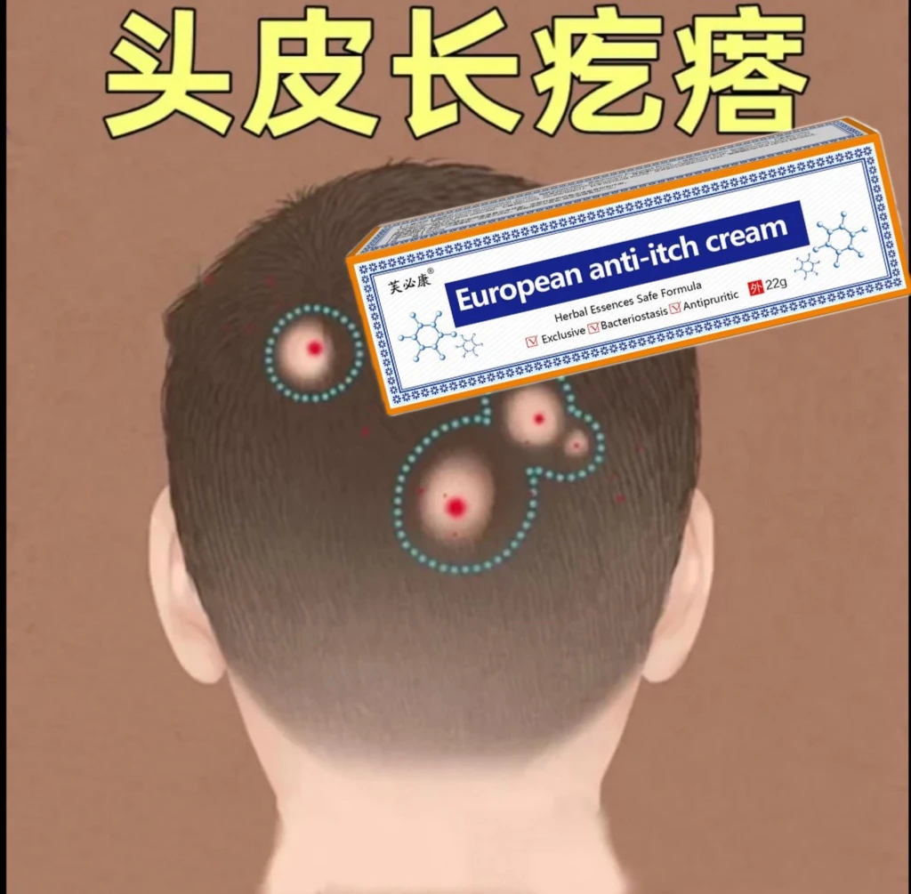 头皮毛囊起小红疙瘩脓包头屑长痘痘头部前胸后背毛囊专用止痒特效