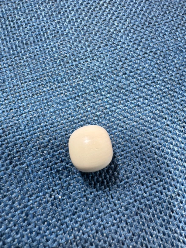 猛犸牙补差价链接