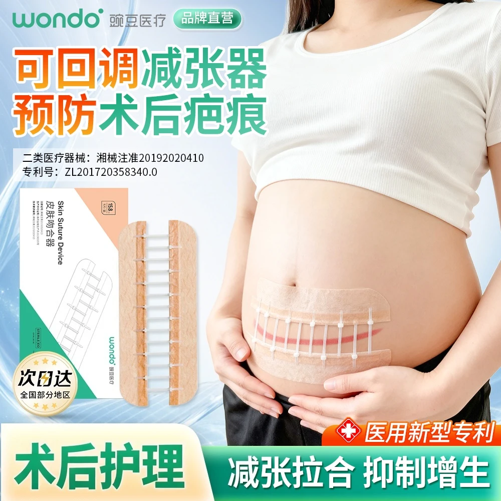 豌豆医疗医用皮肤吻合器 预防疤痕增生术后护理 减张器Pro版减张贴