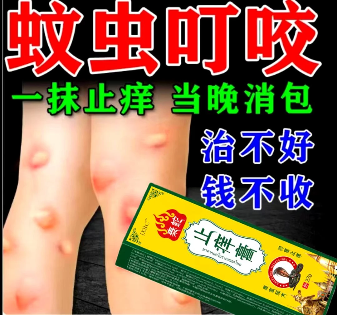 蚊虫叮咬快速止痒消肿膏治婴儿宝宝成人臭虫跳蚤蚊子去黑印抑菌膏