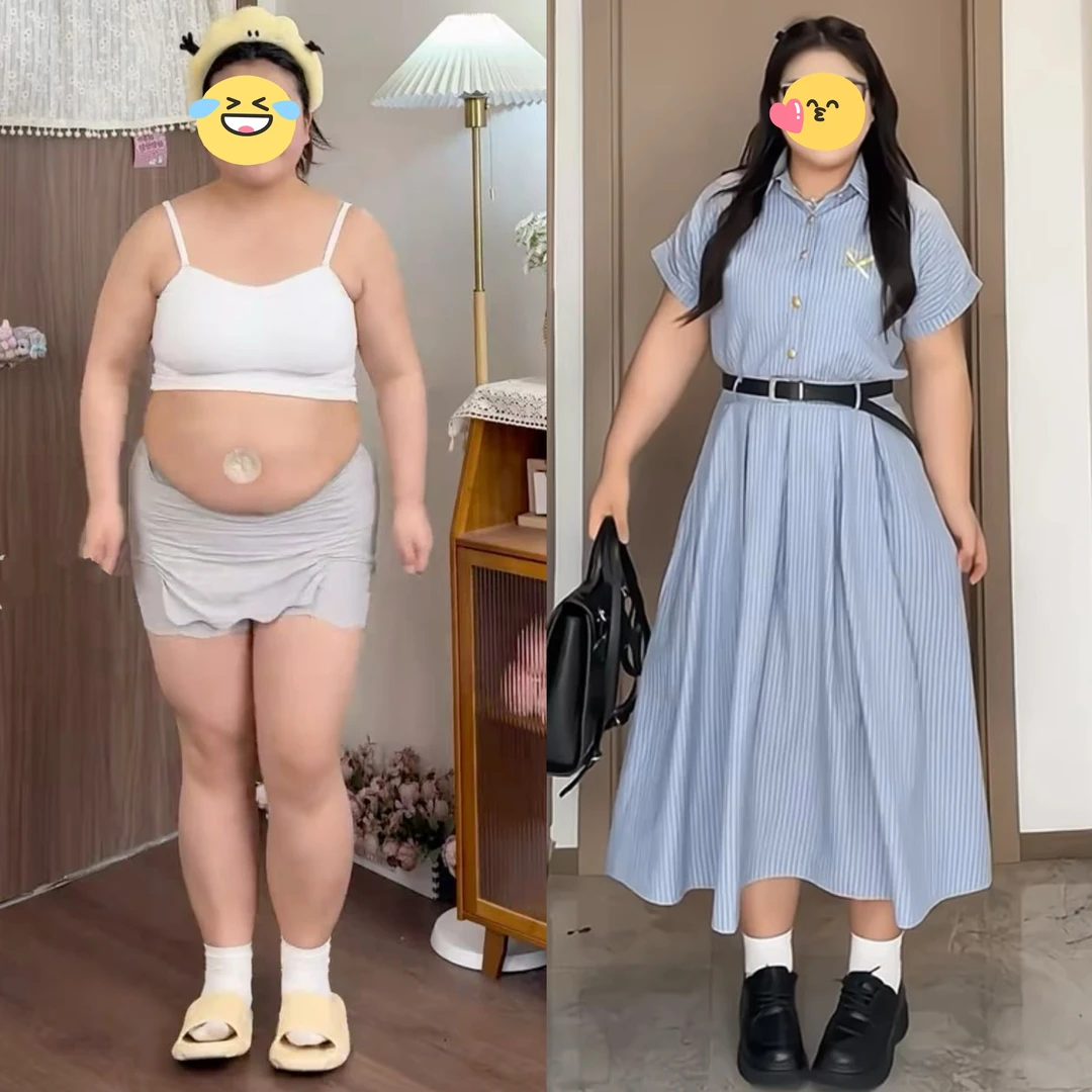 大码女装胖mm学院风POLO领条纹衬衫连衣裙2025夏季显瘦减龄长裙子