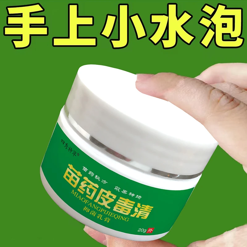 小水泡止痒手痒发红越挠越痒细菌感染手痒起小水泡脱皮裂口手痒