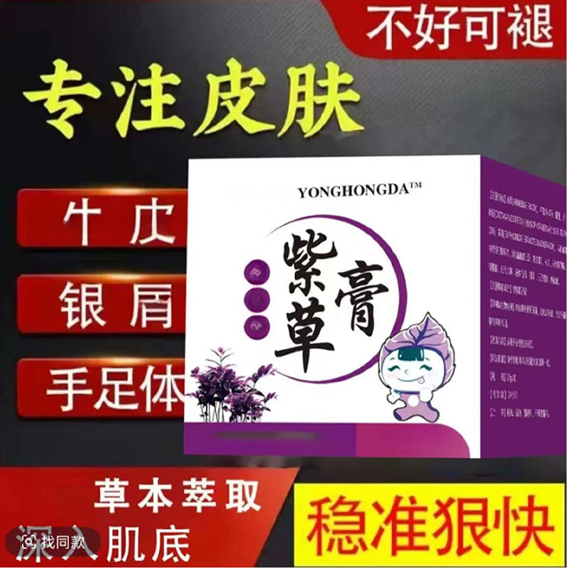 【紫草膏】全身牛/皮/银/屑/手足头体股大腿内侧止痒软膏专用肤癣