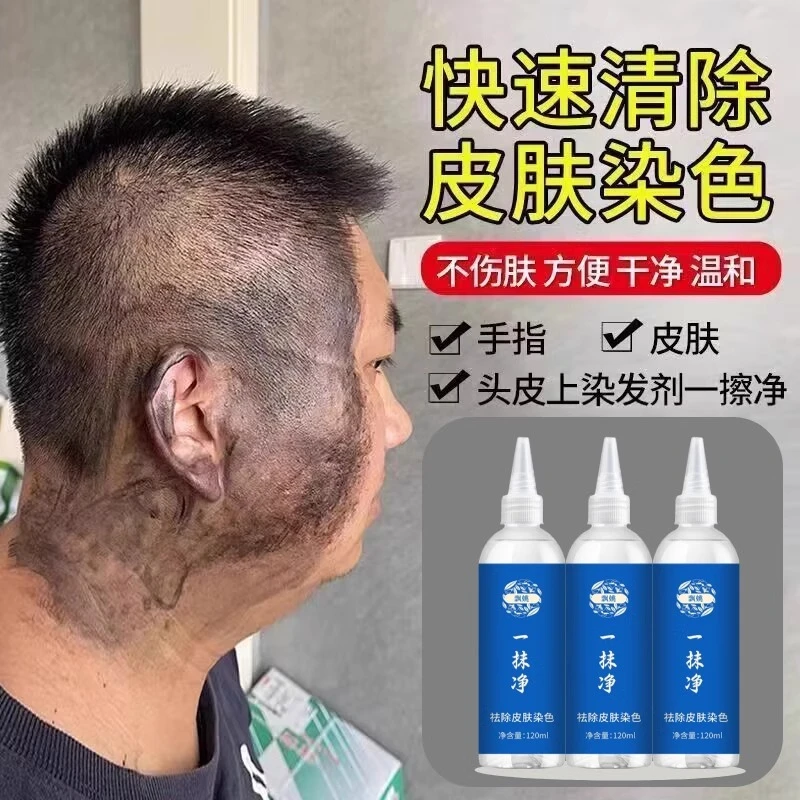 飘姚一擦抹净去除皮肤上染发剂污渍清洗剂祛除染发膏的清洁剂药水