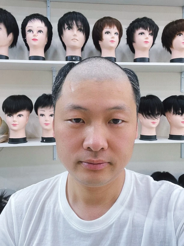 前额孵化全递针随意分缝全真发
