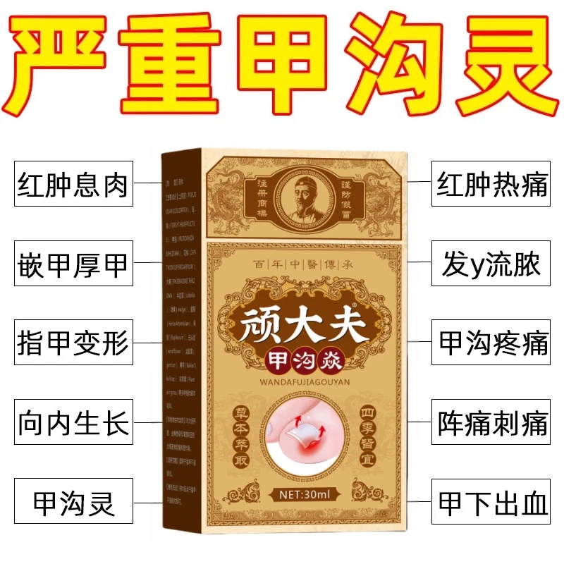 指甲钻肉里疼有脓嵌甲甲沟膏草本成分修复甲沟不用拔指甲特效专用