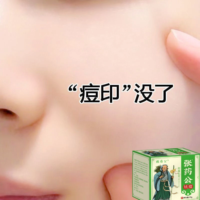 祛痘膏草本萃取温和不刺激应对青春痘粉刺学生专用抑菌膏