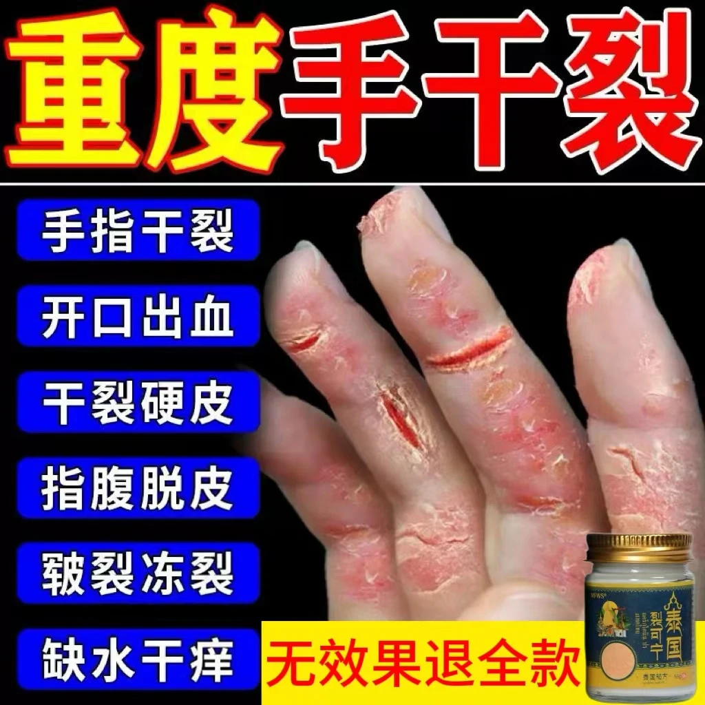 手脚跟裂口子干裂修复膏手足指头开裂防裂护手霜脱皮出血膏裂可宁