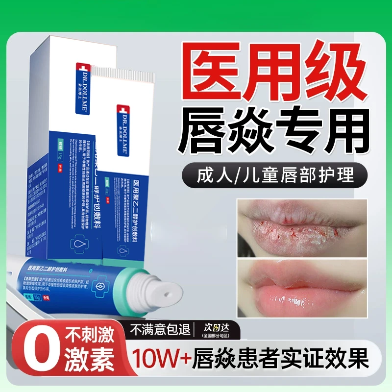 唇焱润唇膏嘴唇干裂脱皮专用保湿滋润去死皮口角焱包疹修护膏