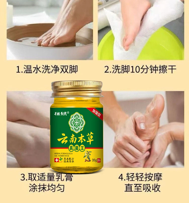 云南真菌王手脚干裂膏全身皮肤问题可用脚干保湿草本温和抑菌乳膏