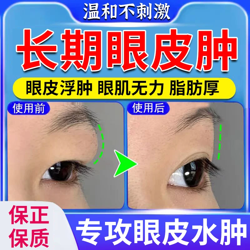 【纯草本消眼肿贴】晨起眼皮水肿浮肿眼皮松弛熬夜眼睛水肿浮肿专用