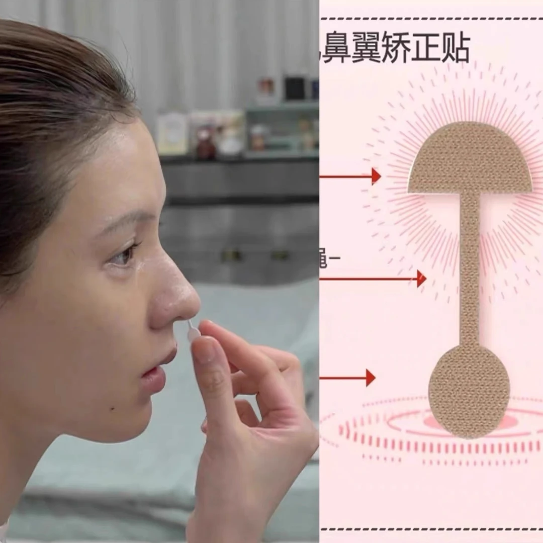 张予曦同款！小哑铃鼻翼贴柔软弹力自粘鼻翼挛缩鼻翼宽鼻孔大矫正
