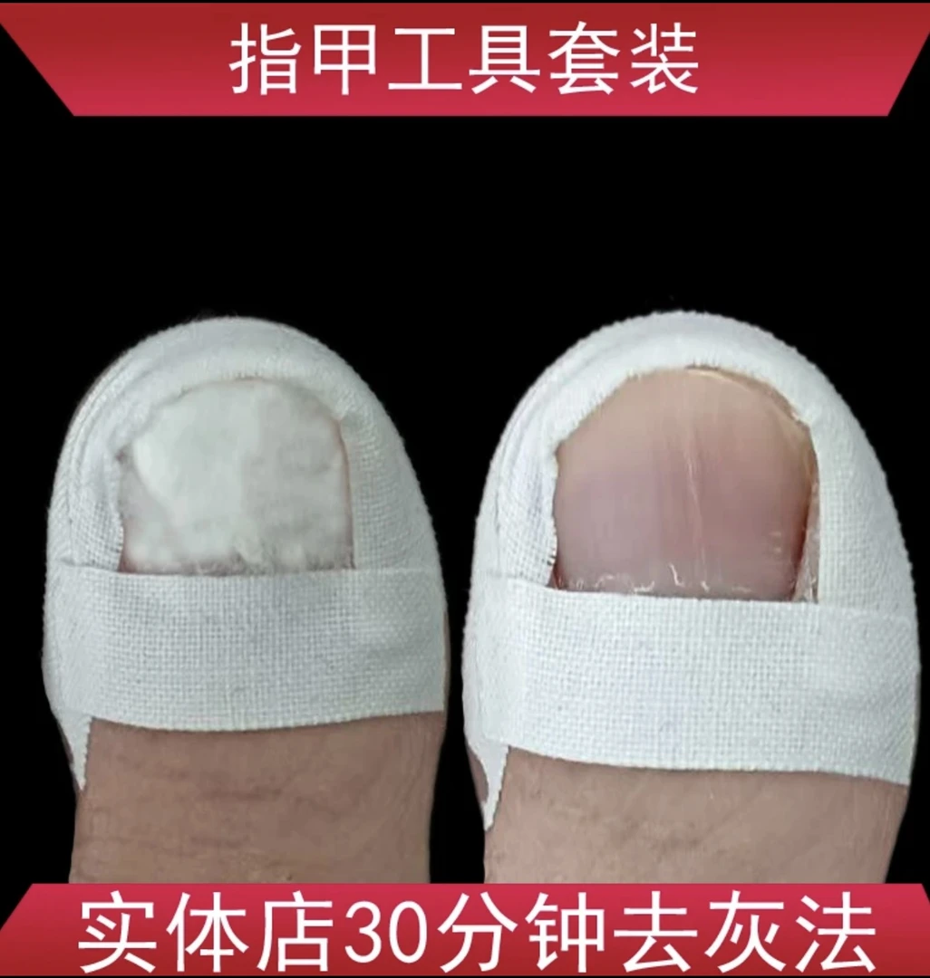 修复亮甲膏趾指甲灰修甲刀套装增厚空甲通用手工