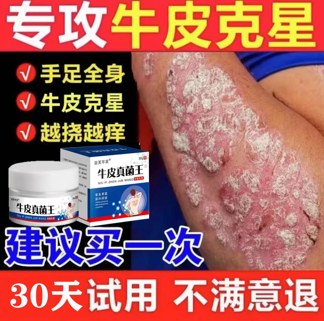 【牛皮真菌王】全身牛/皮/银/屑/手足头体股大腿内侧止痒癣膏药专用