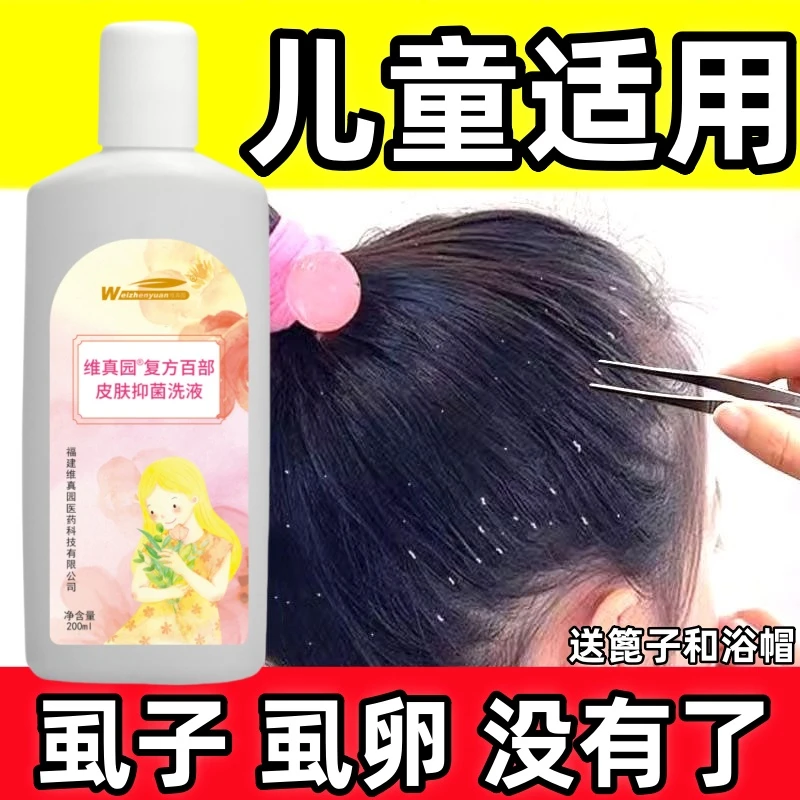 除小女孩头发上长的虱子卵儿童头虱大人虱子香波适用百部酊洗发水