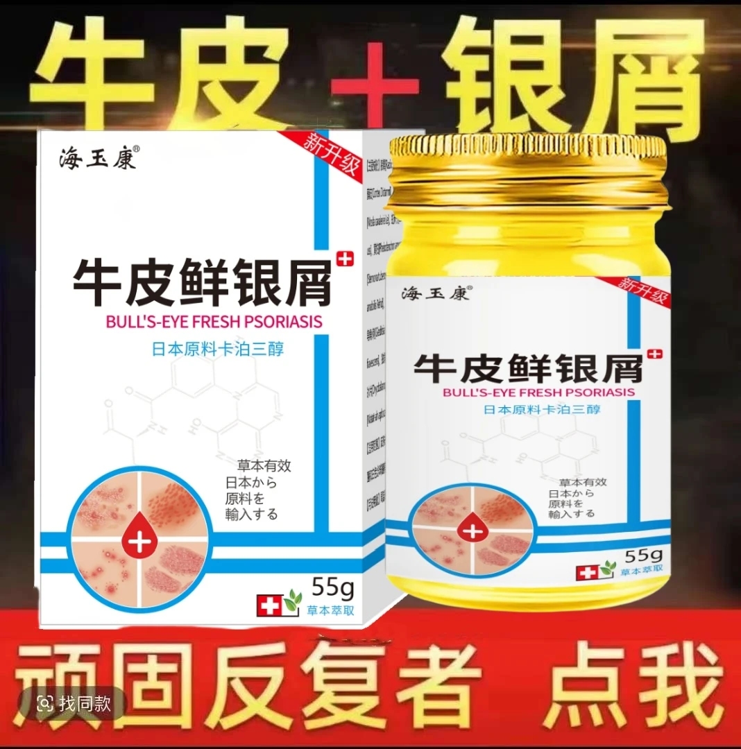 【日本真菌王】全身牛皮/银屑/藓头皮手足体藓大腿内侧草本止痒癣膏