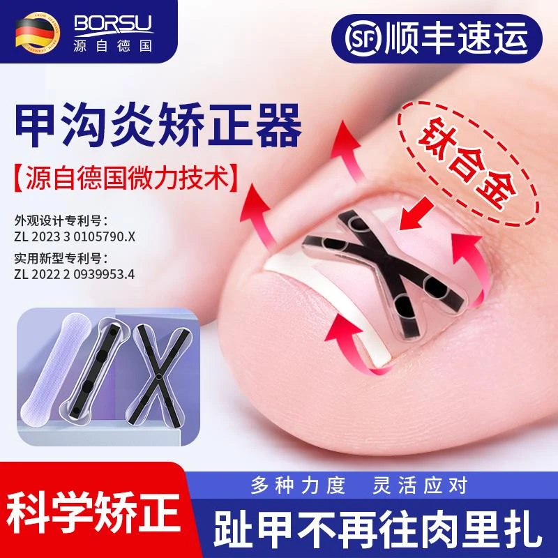 BORSU甲沟嵌甲炎矫正器正甲贴片脚趾指甲刀剪往肉里长贴
