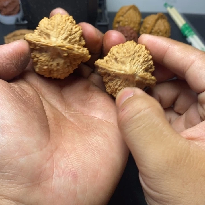 骨质密度绝对没问题