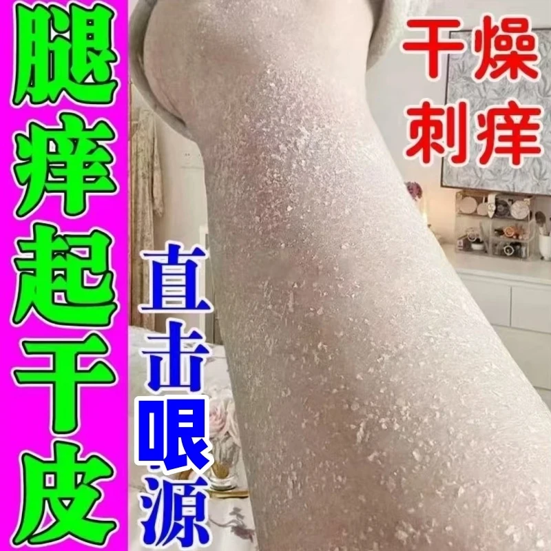 腿上痒干燥起皮红疙瘩小腿皮肤痒秋冬腿部瘙痒越抓越痒止痒抑菌膏