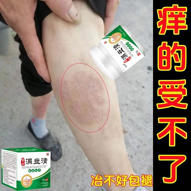 湿立清皮肤瘙痒寻麻痒顽固湿痒皮肤红班止痒膏抑菌身体护理