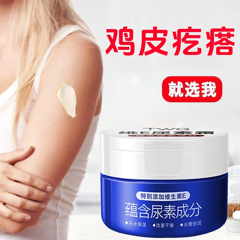 胳膊腿上鸡皮疙瘩毛囊角化手臂密集小颗粒腿上干燥粗糙维E尿素霜