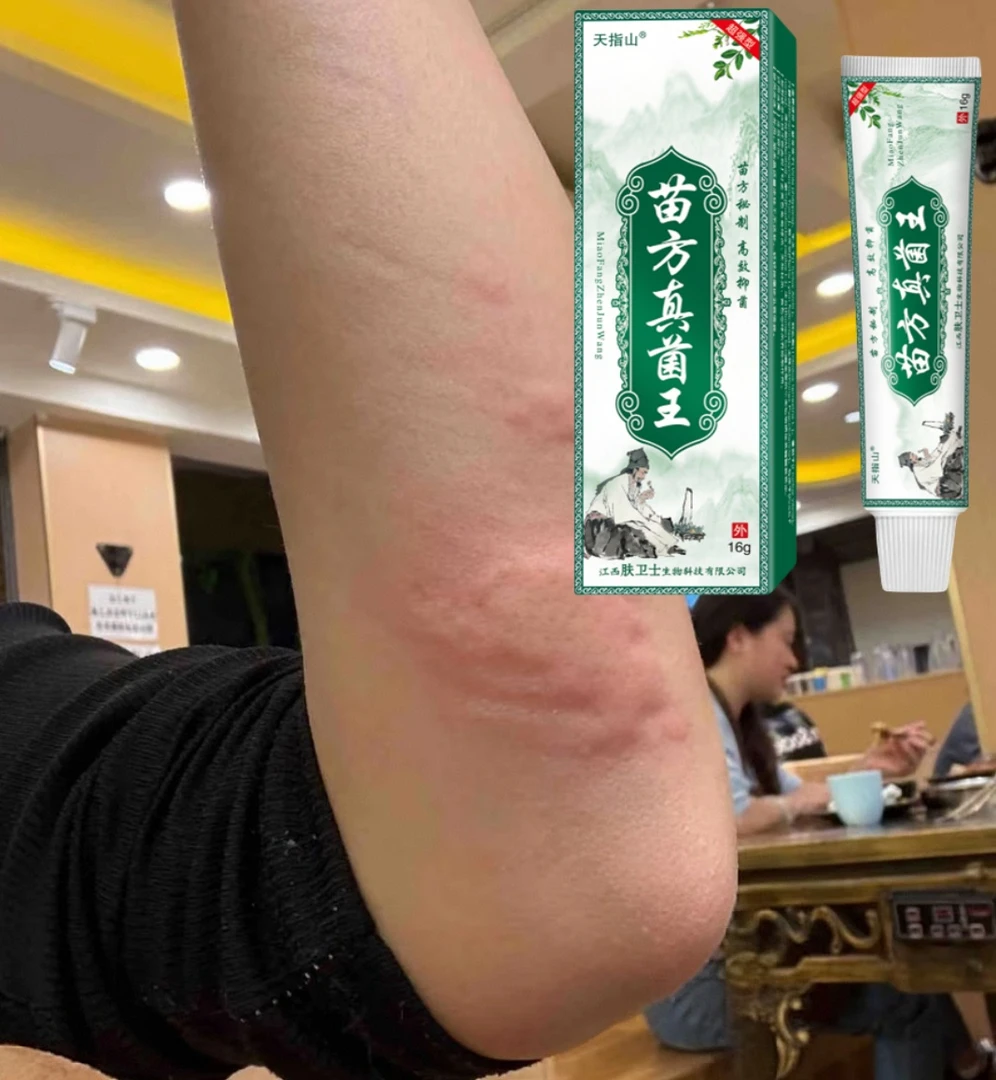 手足长小水泡手指痒起汗手指开裂手部手足脱皮手指脱皮抑菌软膏