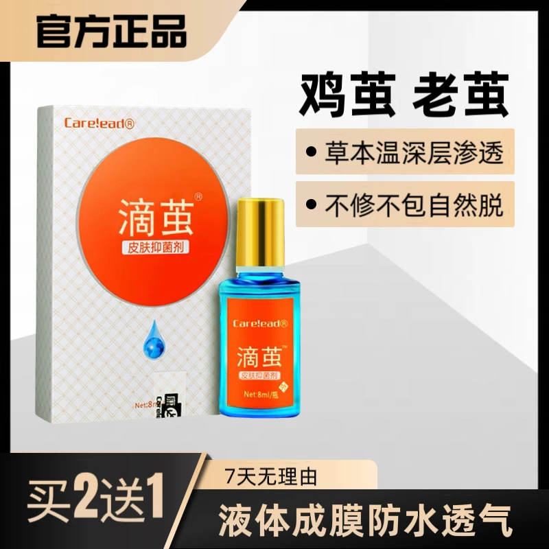 手足老茧脚茧脚钉肉刺脚垫除硬皮老硬茧软化剂草本修护