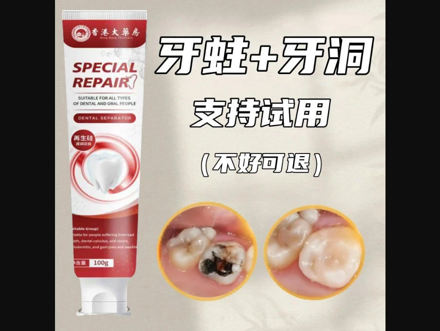 【香港出品】蛀牙专用|牙洞牙黄牙黑敏感|护理牙膏大人小孩通用