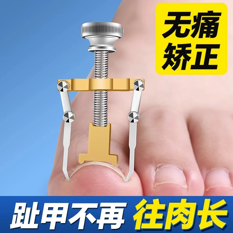 甲沟炎矫正神器嵌甲专用正甲贴指甲矫正器纠正指甲长肉里填充垫片