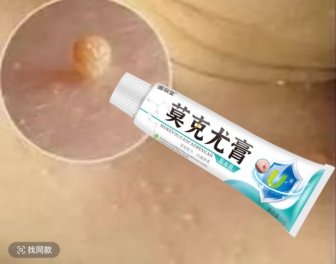 【小肉粒专用】云南白草克尤膏脖子手足腋下丝状扁平肉刺