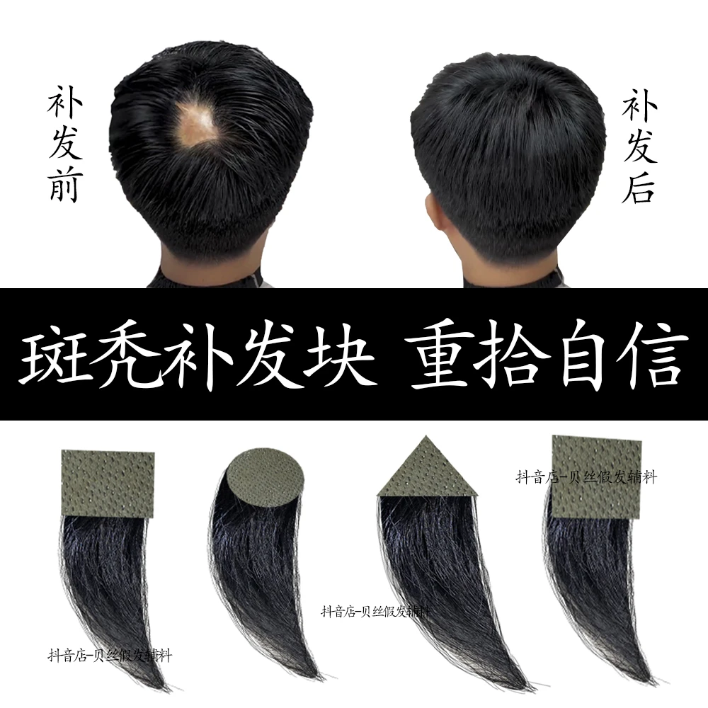 头部疤痕补发斑秃补发片伤疤局部补发头皮小面积补发神器补发片