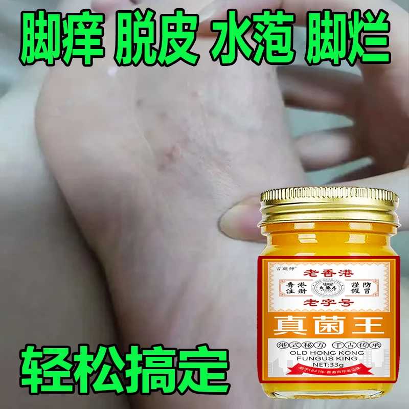 正品真菌王脚臭脚痒脱皮起水萢脚后跟干裂趾缝痒膝肘贴草本抑菌膏