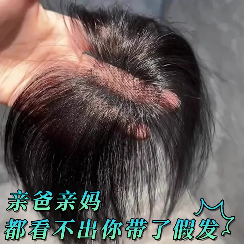 胎毛刘海假发女片头顶遮秃顶神器高颅顶蓬松真发无痕发际线假发贴