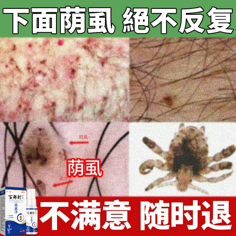 百部酊去虱净成人私处男女通用彻底消灭阴虱专用阴虱源头哪里来的