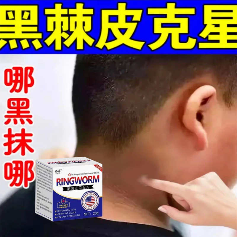 去全身嫩白黑棘皮脖子黑腋下黑大腿肩颈臀部坐印黑色素沉淀膏