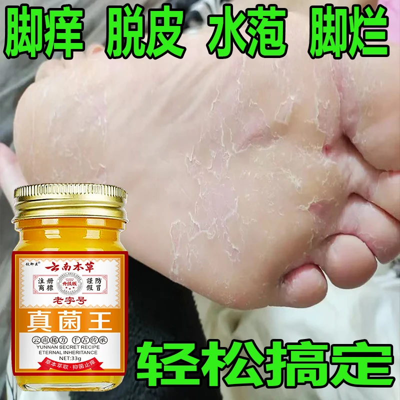 正品真菌王脚痒脚臭脚缝痒脱皮脚底痒脚止痒膏肩颈贴脚部问题适用