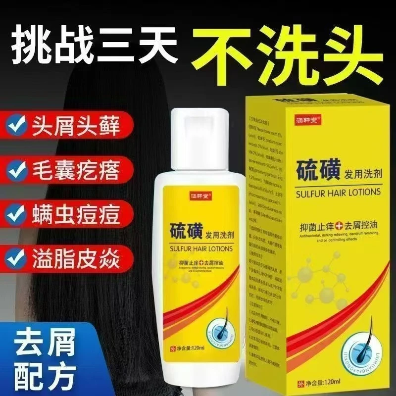 【告别头屑头螨】硫磺洗发水去屑止痒深层清洁除螨控油洗头膏男女