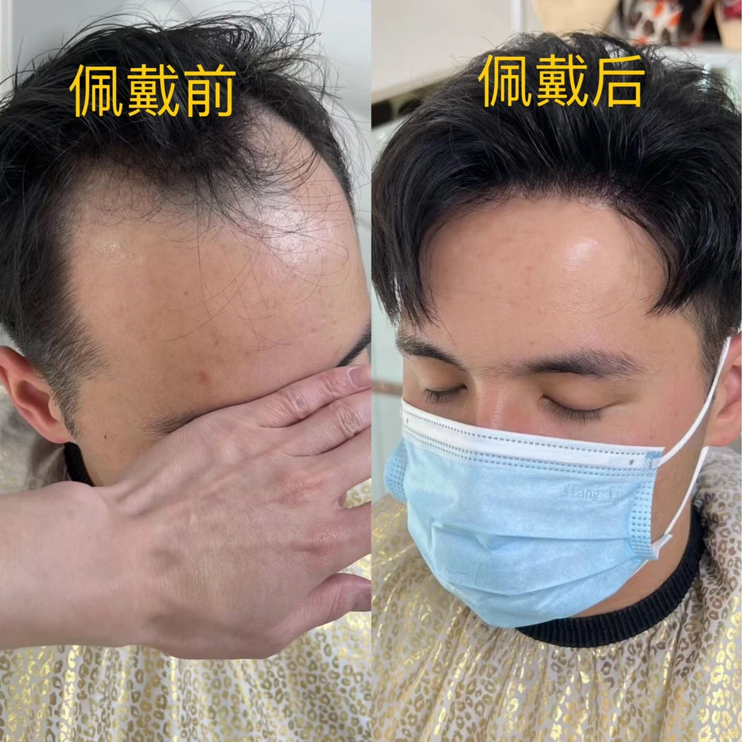 男士超薄生物头皮发际线假发贴拯救发际线全真发自然逼真遮盖额头