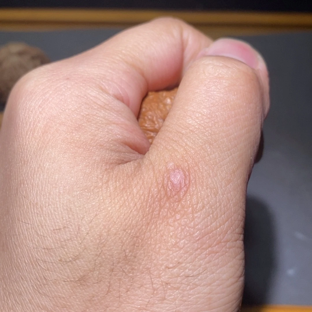 十***七核桃核桃核桃核桃核桃核桃