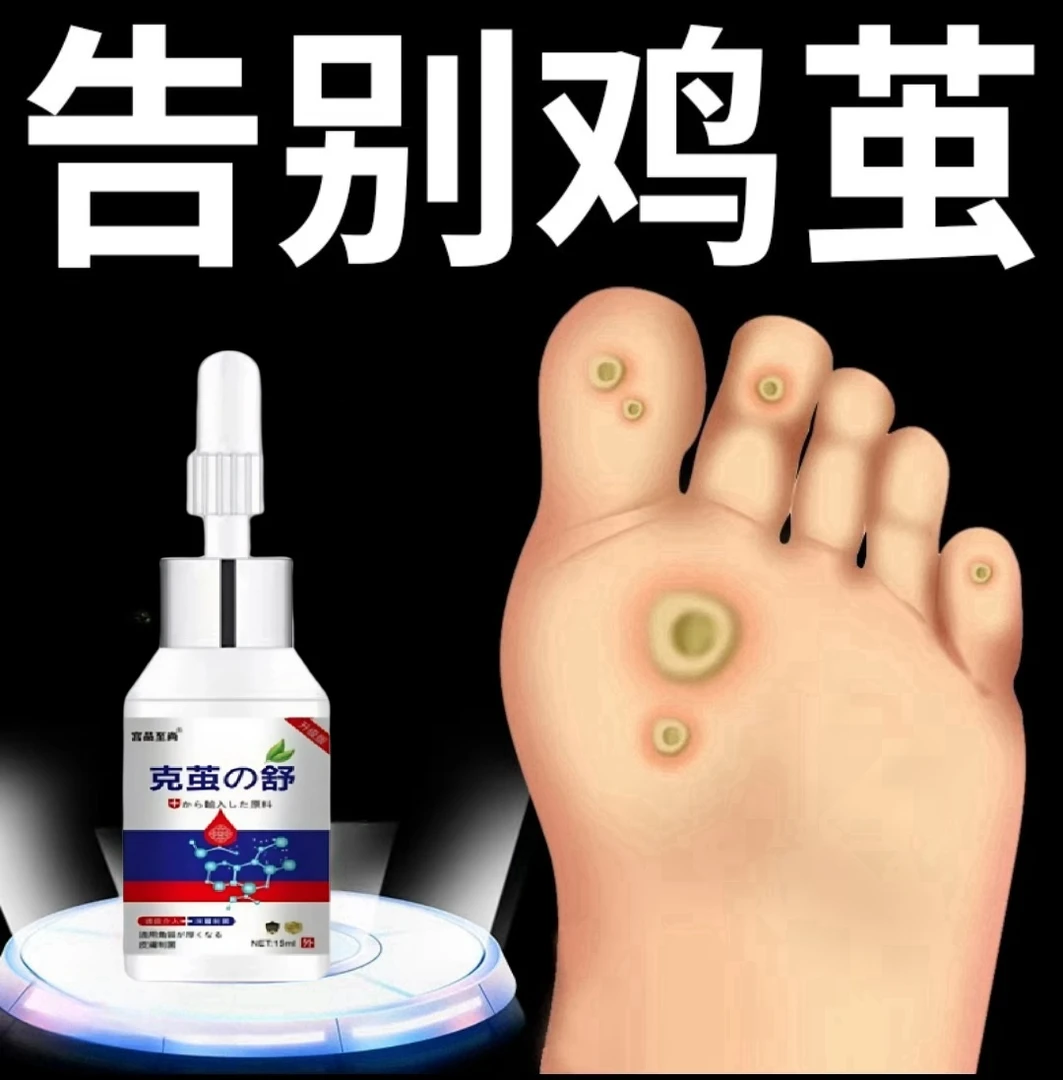 脚底鸡茧肉刺走路疼脚钉去除液脚跖瘊发硬老茧去除神器修护软化液