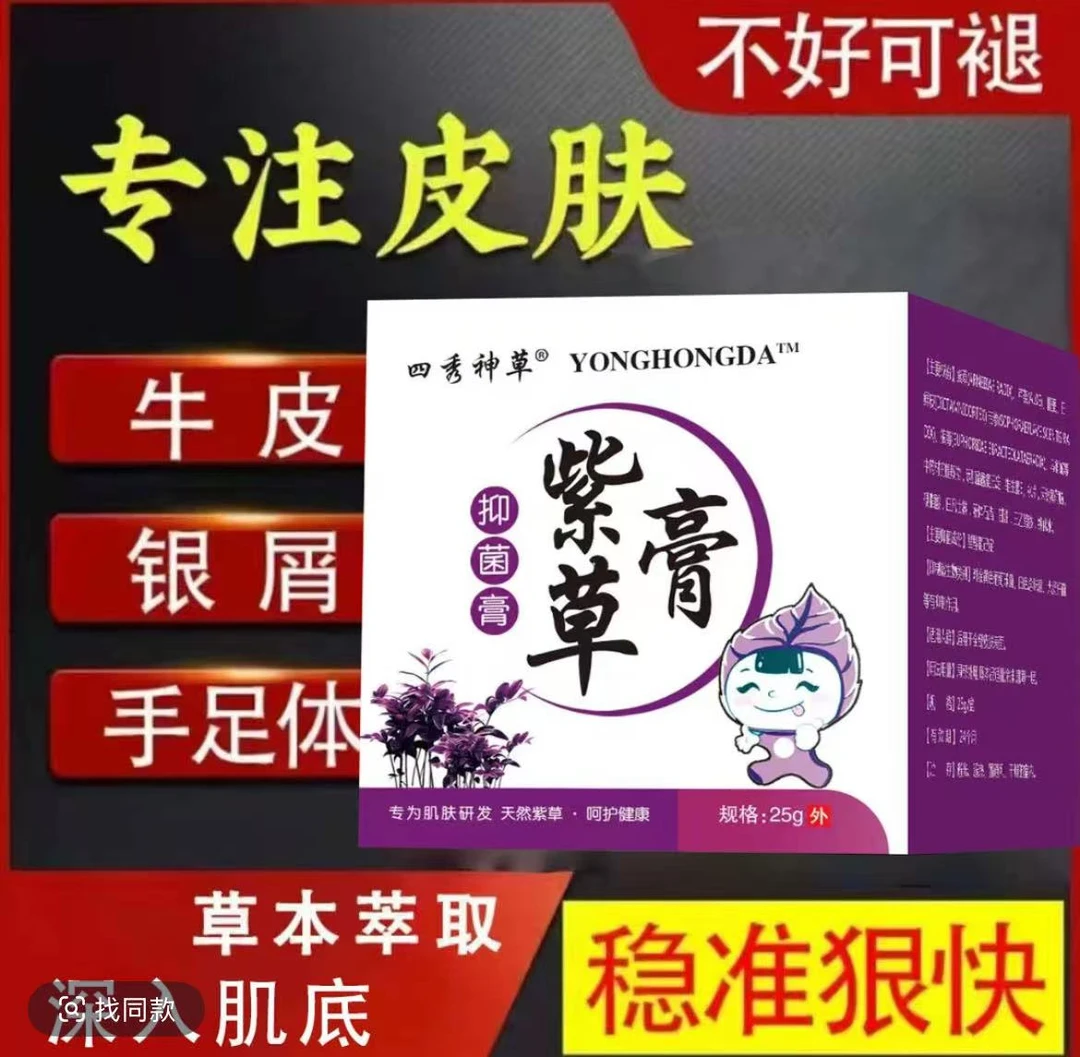【紫草膏】全身牛/皮/银/屑/手足头体股大腿内侧止痒软膏专用肤癣