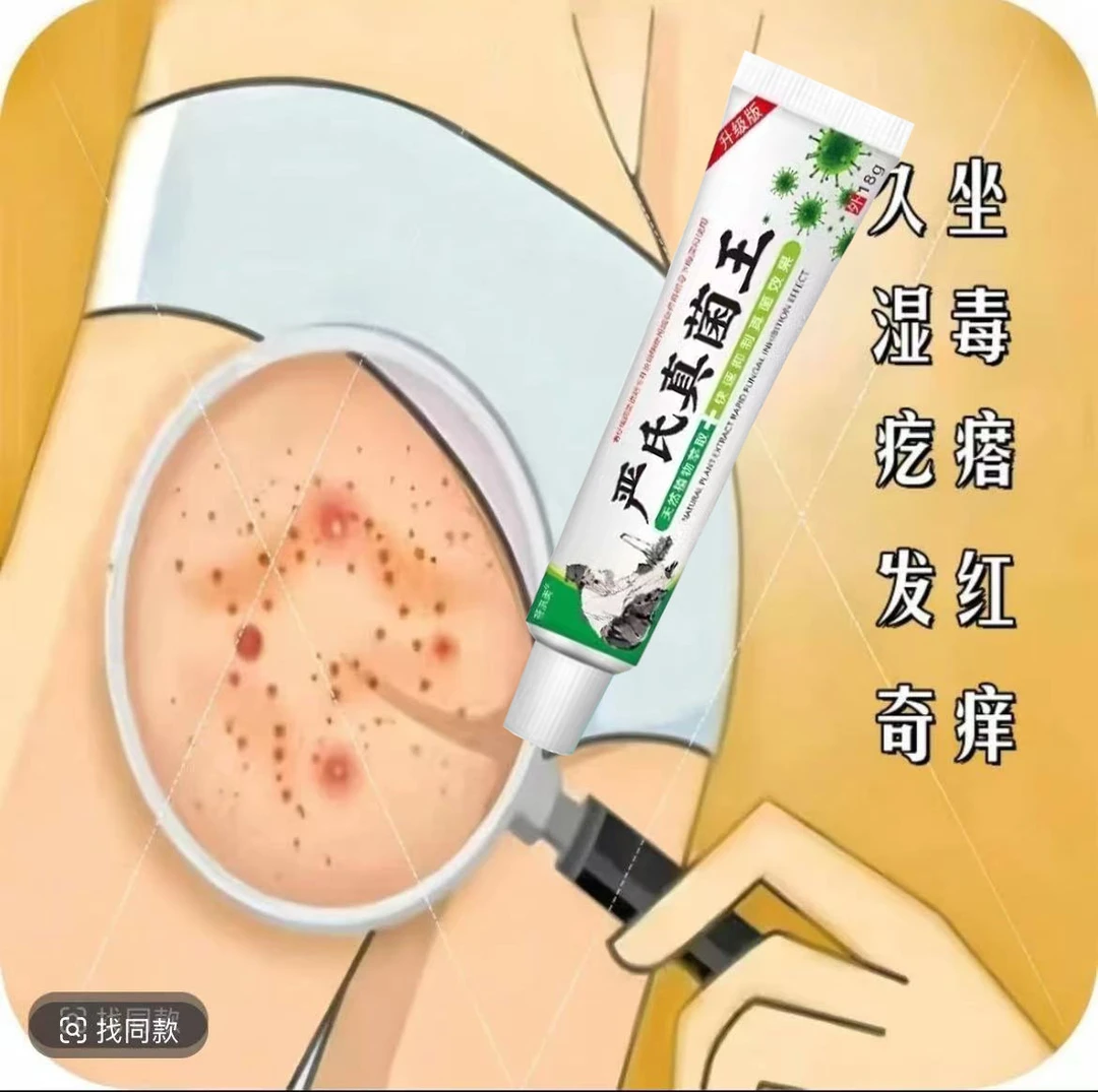 身上起疙瘩脖子屁股疙瘩久坐闷出痘身上痒起疙瘩抑菌止痒