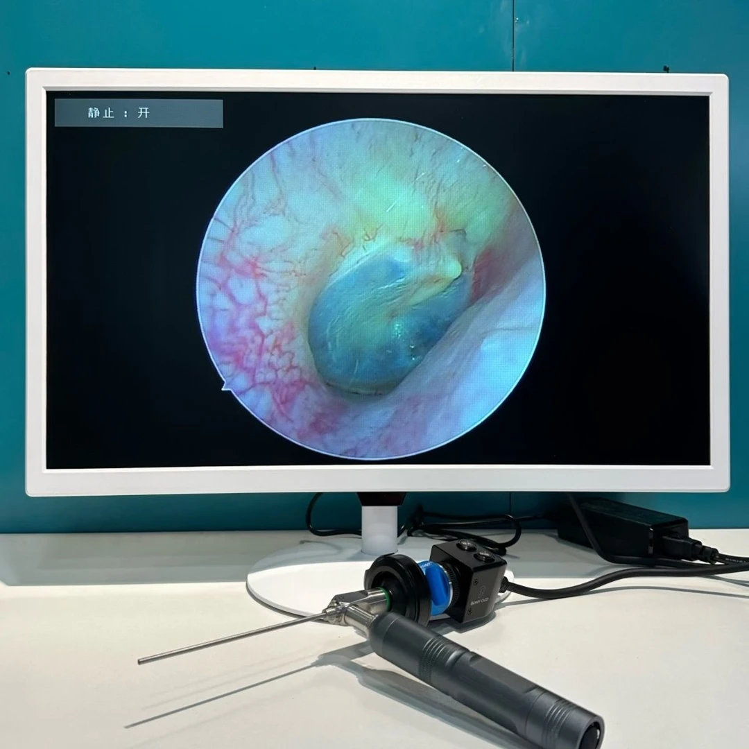 户外款可视采耳设备高清高亮采耳仪器带支架耳鼻镜
