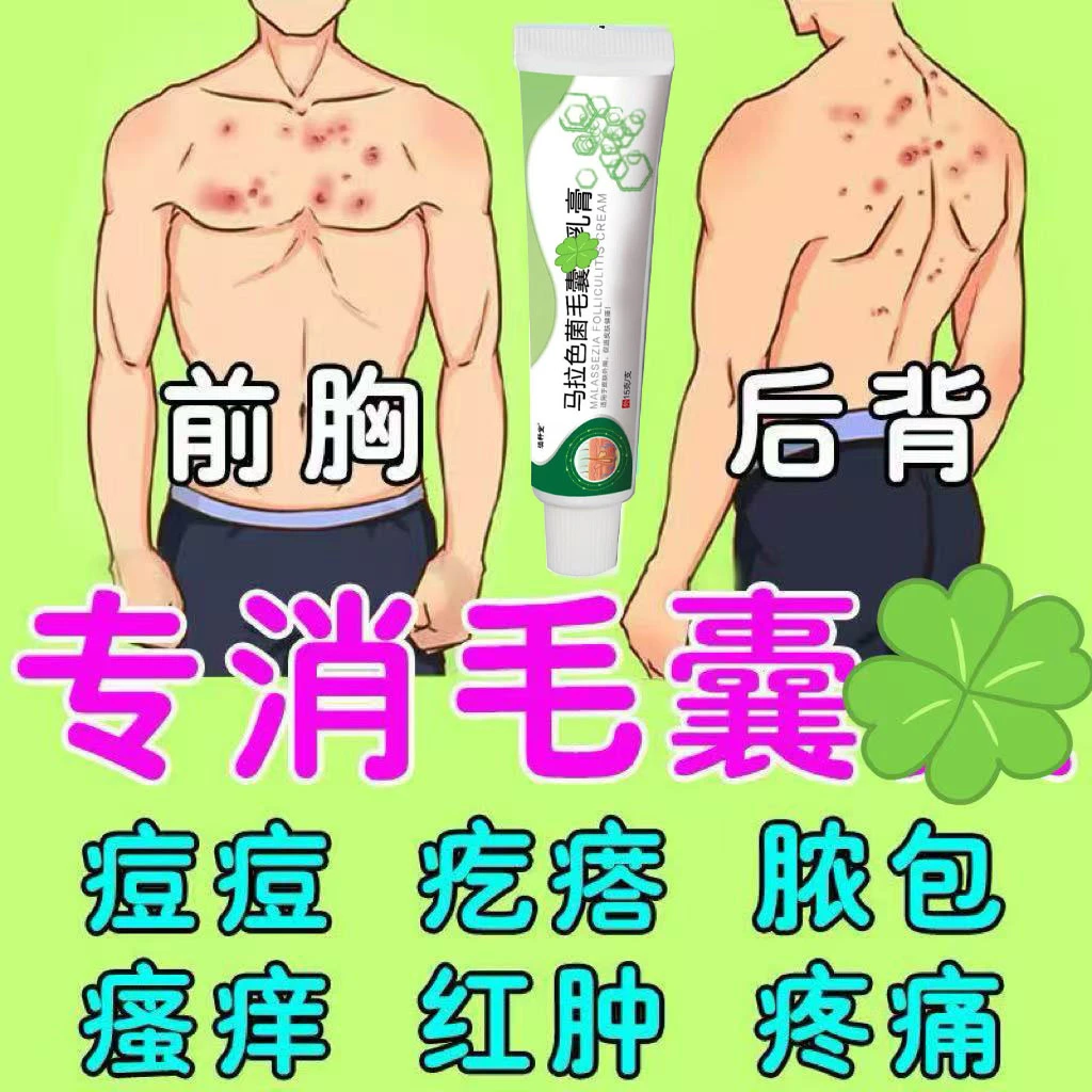 毛/囊/焱药前胸后背头顶后背堵塞流脓包痘痘疙瘩瘙痒疼痛红肿发热