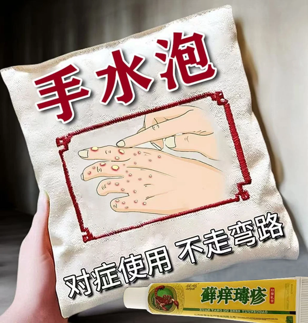 手起泡疙瘩痒皮损发痒四季修护止痒抑菌膏