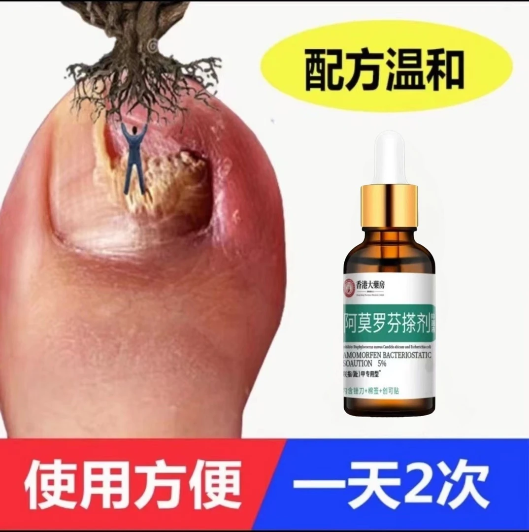 趾甲脚指甲专用抑菌液趾甲复抑菌液指甲专用抑菌液草本萃取温和