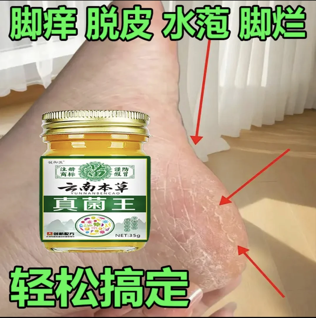 正品真菌王脚臭脚痒脱皮起水萢脚后跟干裂趾缝痒膝肘贴草本抑菌膏