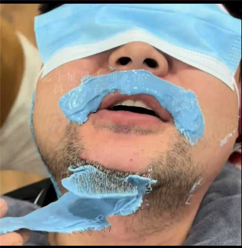 脱毛膏新款自粘撕拉式可用于面部胡子脱毛去黑头