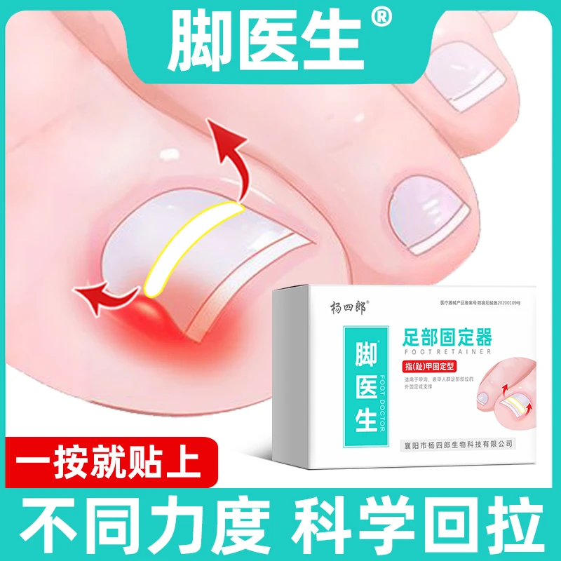 JIAOYISHENG/脚医生脚趾甲贴片嵌甲甲沟炎矫正指甲专用正甲贴足部固定器